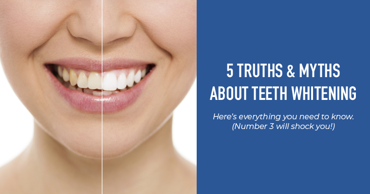 https://www.ruledds.com/wp-content/uploads/2021/09/myths-and-truths-teeth-whitening.png